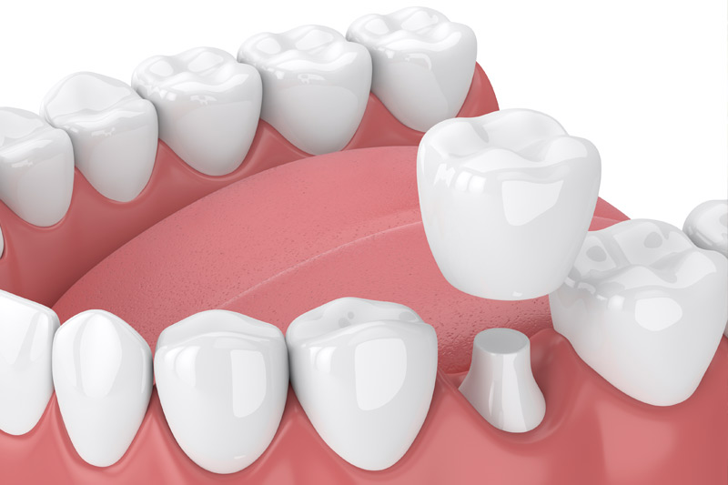 Quality Dental Treatments in Austin